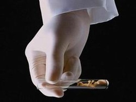 巧囊也能做试管婴儿，这些事情需注意